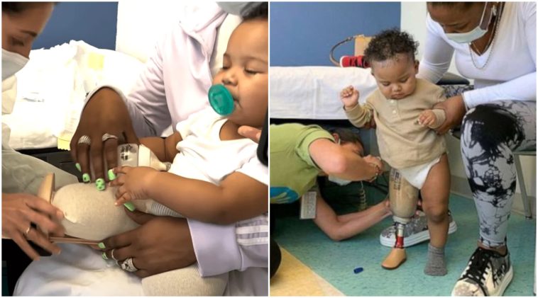 Az 1 éves babának amputálták a lábát, de nem adta fel és 8 hónap után megteszi az első lépéseit